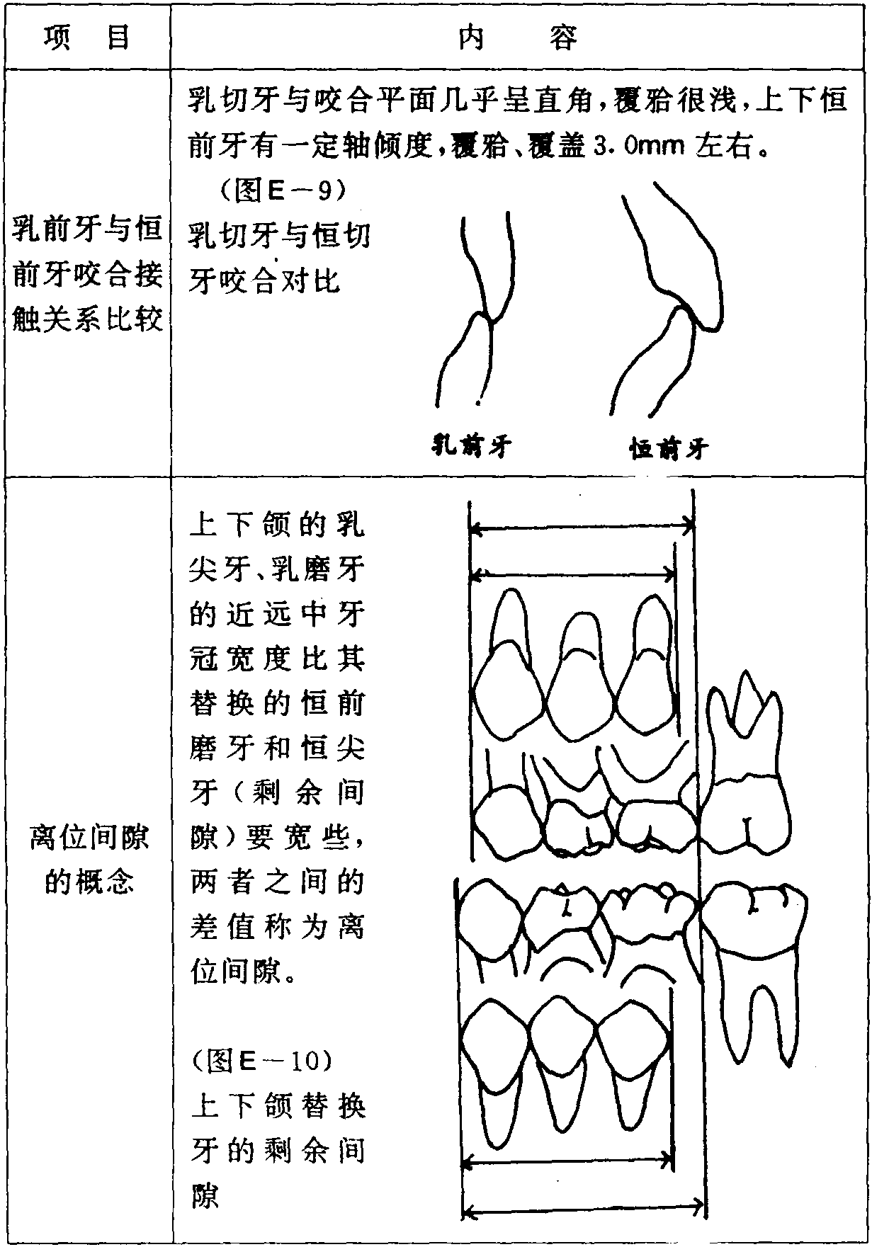 E-4 乳牙列和乳牙咬合